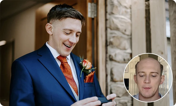 ¿Qué es un sistema capilar?